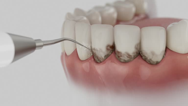 Reliable Tooth Extraction contractor in Houston County County, TN by Dentist Open Now